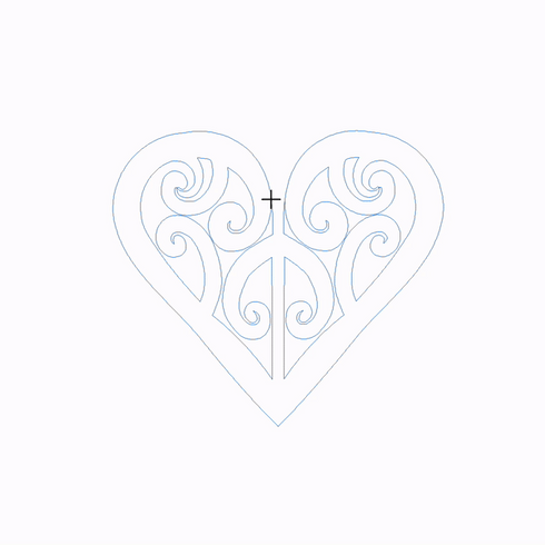 New Zealand Heart Block